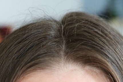 Senza styling. I baby hair spuntano in aria e i miei capelli non hanno lo stesso aspetto da entrambe le parti della riga.