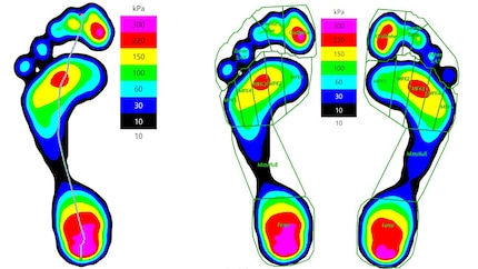 À gauche, la ligne de progression de la marche de mon pied gauche. À droite, la comparaison des deux pieds révèle de légères différences dans la répartition de la pression.
