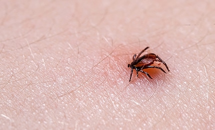 Ticks don’t bite; they sting.