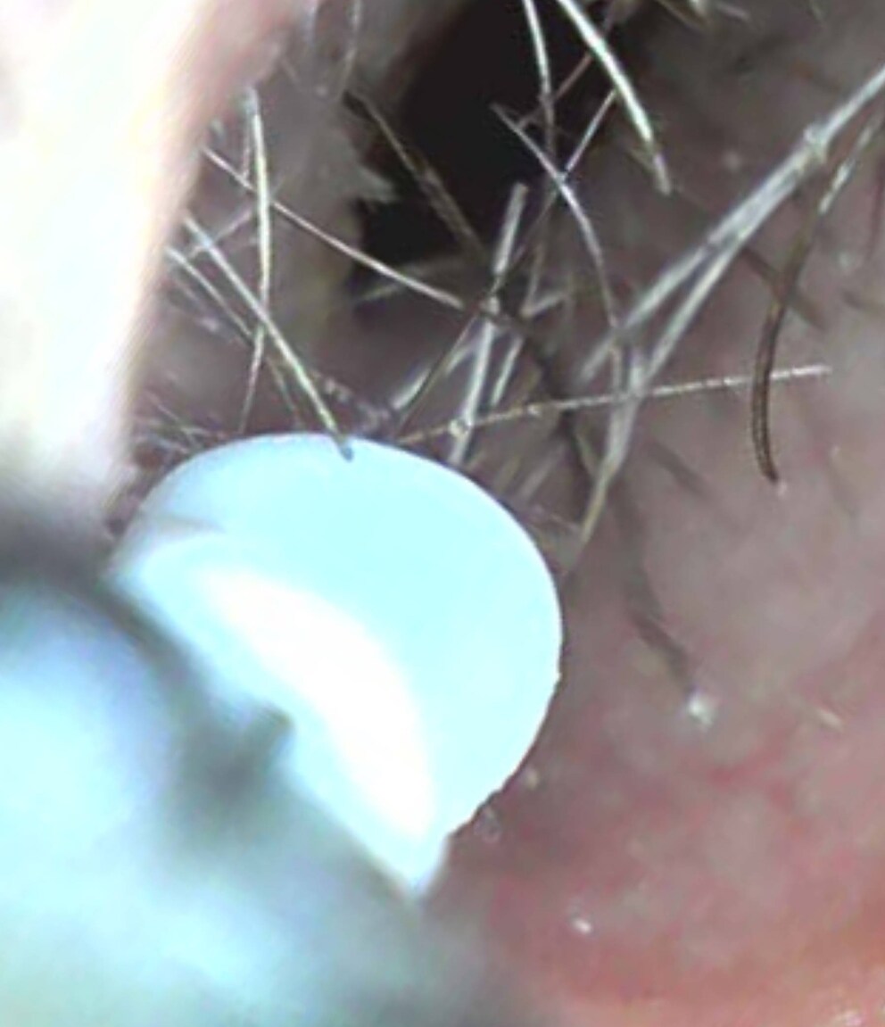 Nose hairs or tree trunks? Thanks a lot, Bebird camera ... 