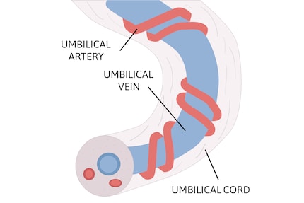 Im Innern der Nabelschnur verlaufen zwei Arterien spiralförmig um eine Vene.