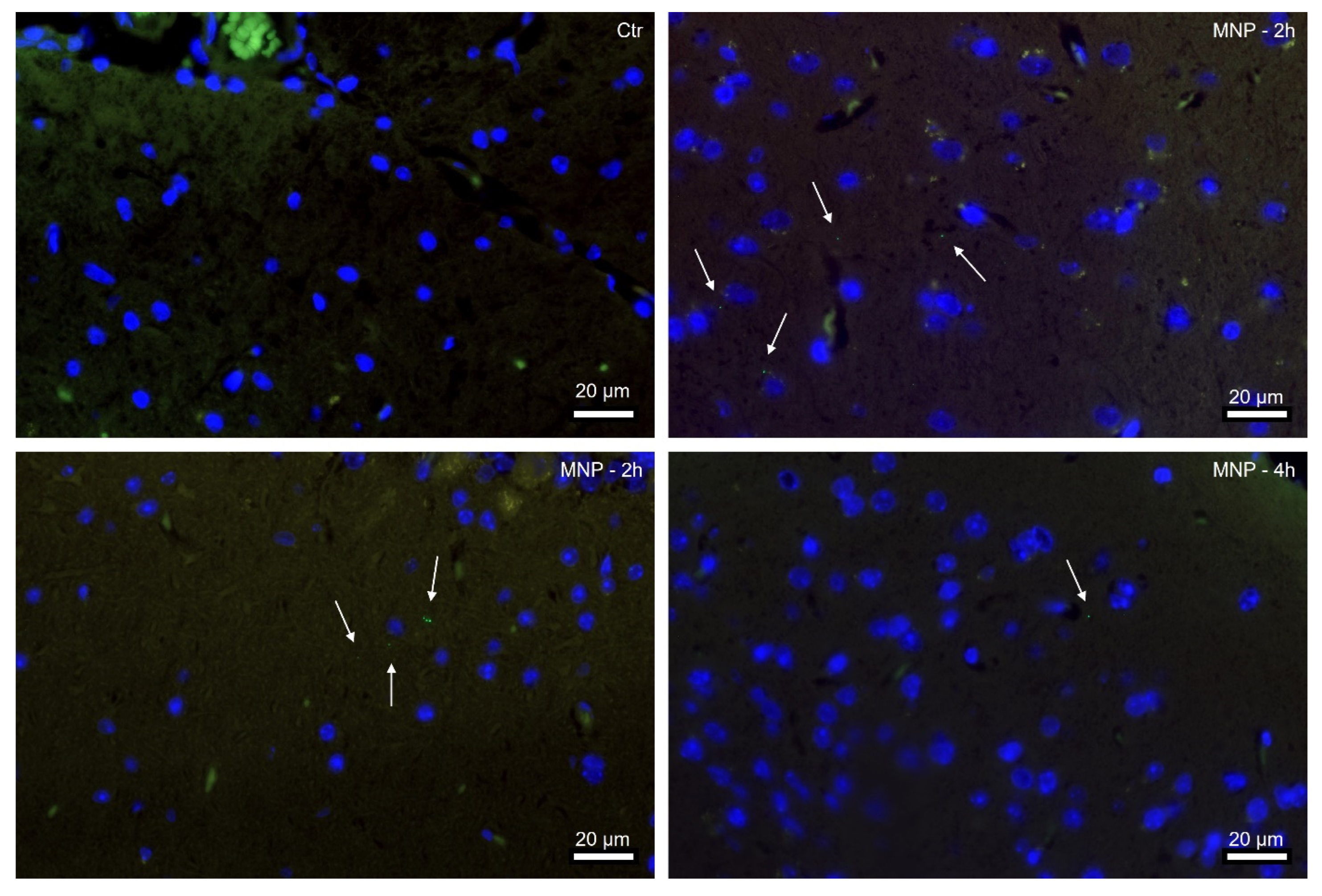 Solo due ore dopo aver ingerito le nanoparticelle etichettate con marcatori fluorescenti verdi, queste erano visibili nel cervello dei topi. 