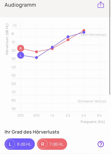 In quale area hai problemi? L'audiogramma lo mostra.