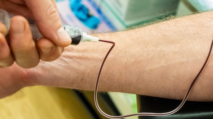 Poi viene prelevato il sangue.