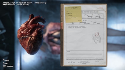 Mentre esegui l'autopsia dei corpi, scopri anche qualcosa di più su Jack e sul suo passato.