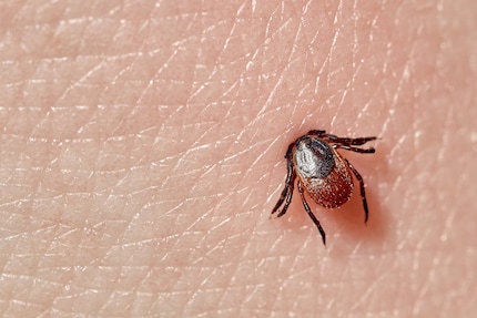 La tique commence par déchirer votre peau, puis elle pique dans la plaie avec son rostre. Et elle commence par bien se gorger d'eau. 