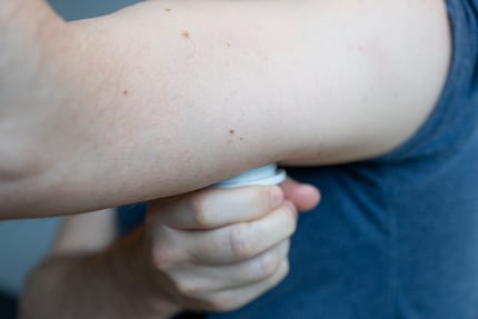 Mit leichtem Druck bringt Res den Sensor an seinem Oberarm an.