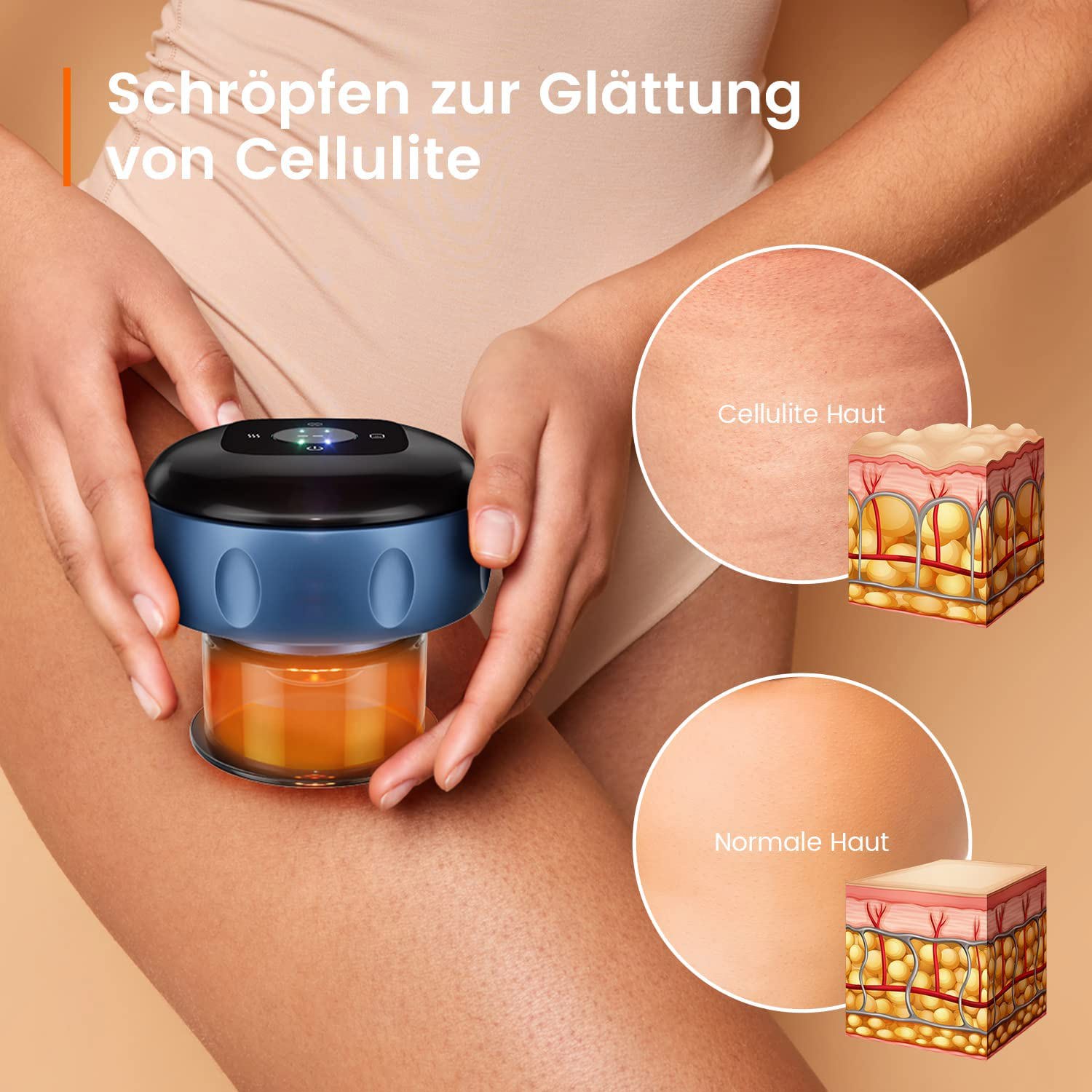 Rimba Elektro Schröpfsauger mit 12 Niveaus kaufen BC7837